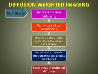 DIFFUSION WEIGHTED IMAGING
Increased tissue
cellularity
Tightly packed cell
membranes
Breakdown of interstitial
spaces that allow for free
water diffusion
Normal random brownian
motion of the cells protons
are inhibited
Focal areas of restricted
diffusion
Ca Prostate
 