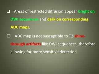  Areas of restricted diffusion appear bright on
DWI sequences and dark on corresponding
ADC maps.
 ADC map is not susceptible to T2 shine-
through artifacts like DWI sequences, therefore
allowing for more sensitive detection
 