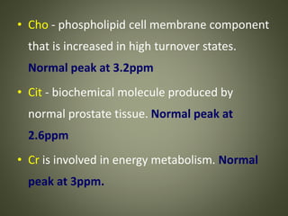 • Cho - phospholipid cell membrane component
that is increased in high turnover states.
Normal peak at 3.2ppm
• Cit - biochemical molecule produced by
normal prostate tissue. Normal peak at
2.6ppm
• Cr is involved in energy metabolism. Normal
peak at 3ppm.
 