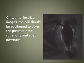 On sagittal localizer
images, the coil should
be positioned to cover
the prostate base
superiorly and apex
inferiorly.
 
