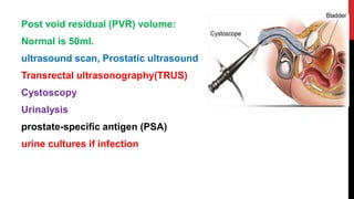 Post void residual (PVR) volume:
Normal is 50ml.
ultrasound scan, Prostatic ultrasound
Transrectal ultrasonography(TRUS)
Cystoscopy
Urinalysis
prostate-specific antigen (PSA)
urine cultures if infection
 