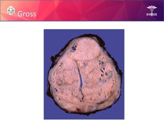 Prostate Diseases by Mam Rabia!.pptx slides | PPTX