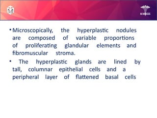 Prostate Diseases by Mam Rabia!.pptx slides | PPTX
