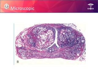 Prostate Diseases by Mam Rabia!.pptx slides | PPTX