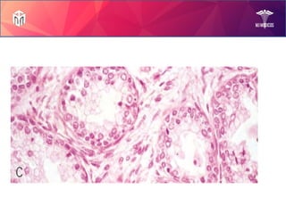 Prostate Diseases by Mam Rabia!.pptx slides | PPTX