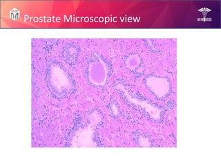 Prostate Diseases by Mam Rabia!.pptx slides | PPTX