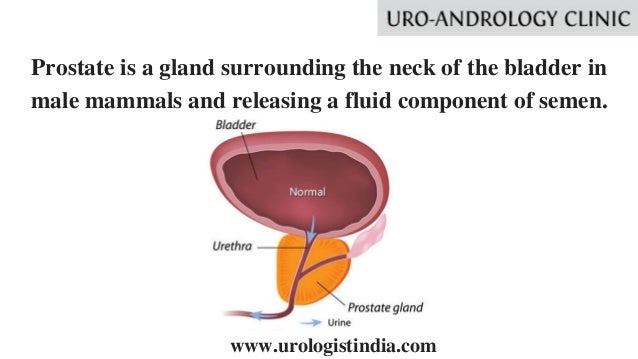 Prostate Enlargement Treatment In Tamil Nadu Best Urologist In Ind