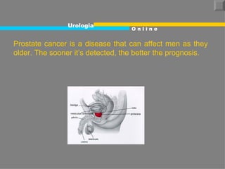 Prostate cancer is a disease that can affect men as they older. The sooner it’s detected, the better the prognosis.  Urologia O n l i n e 