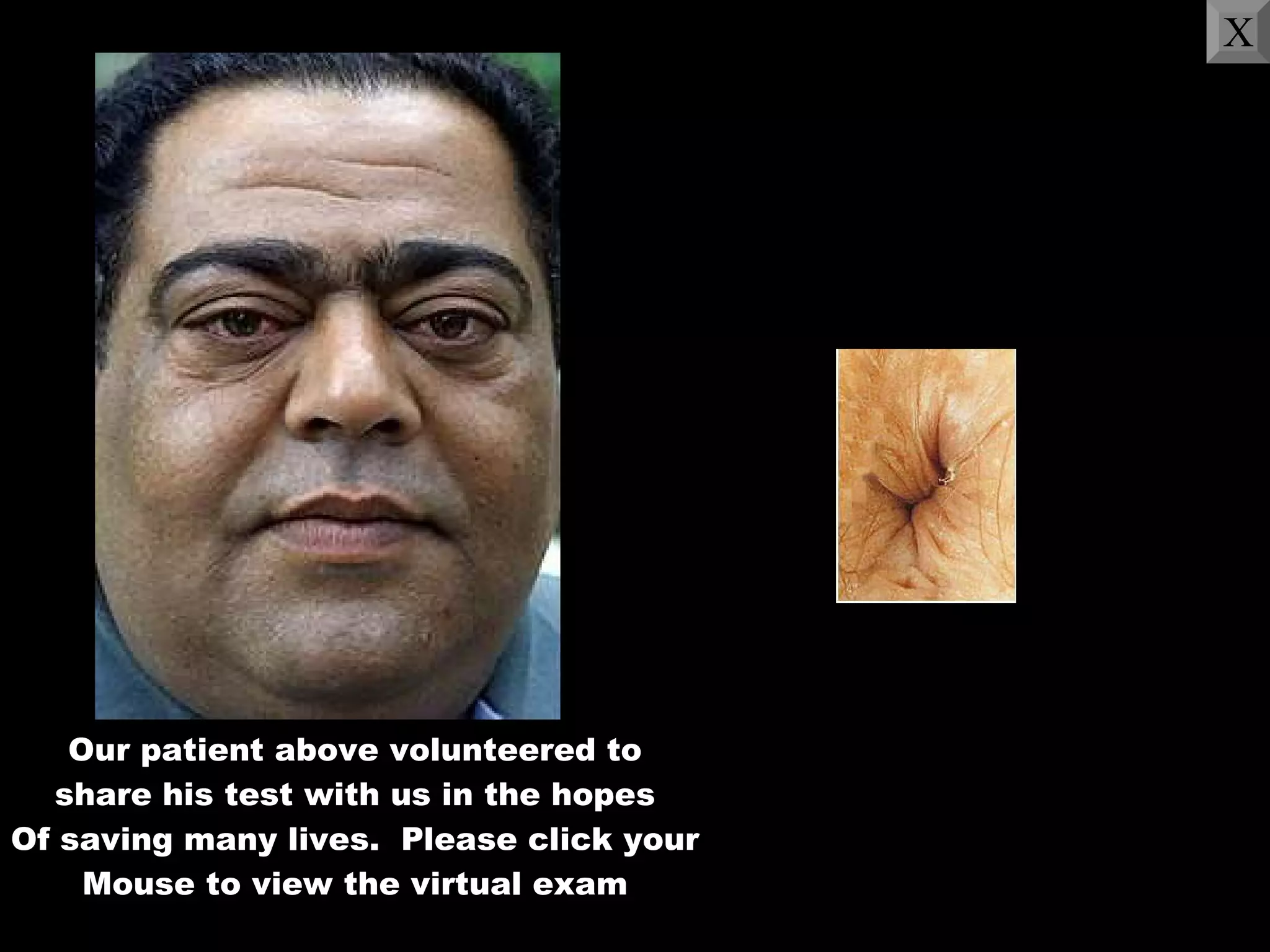 Our patient above volunteered to share his test with us in the hopes Of saving many lives.  Please click your Mouse to view the virtual exam X 