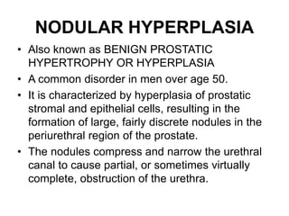 PROSTATE GLAND-1.ppt777777777777777777777777777777 | PPT