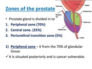 Zones of the prostate
• Prostate gland is divided in to
1. Peripheral zone (70%)
2. Central zone. (25%)
3. Periurethral transition zone (5%)
1) Peripheral zone – it from the 70% of glandular
tissue.
It is situated posteriorly and is cancer vulnerable.
 