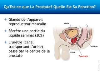 PN876703Rev.B7/13
Qu'Est-ce-que La Prostate? Quelle Est Sa Fonction?
 Glande de l’appareil
reproducteur masculin
 Sécrète une partie du
liquide séminal (30%)
 L’urètre (canal
transportant l’urine)
passe par le centre de la
prostate Prostate
Rectum
Vessie
Urètre
 
