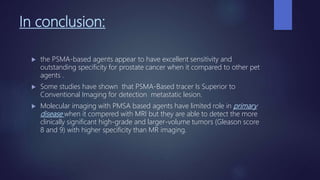 Pmsa Radiology Prostate imaging | PPTX
