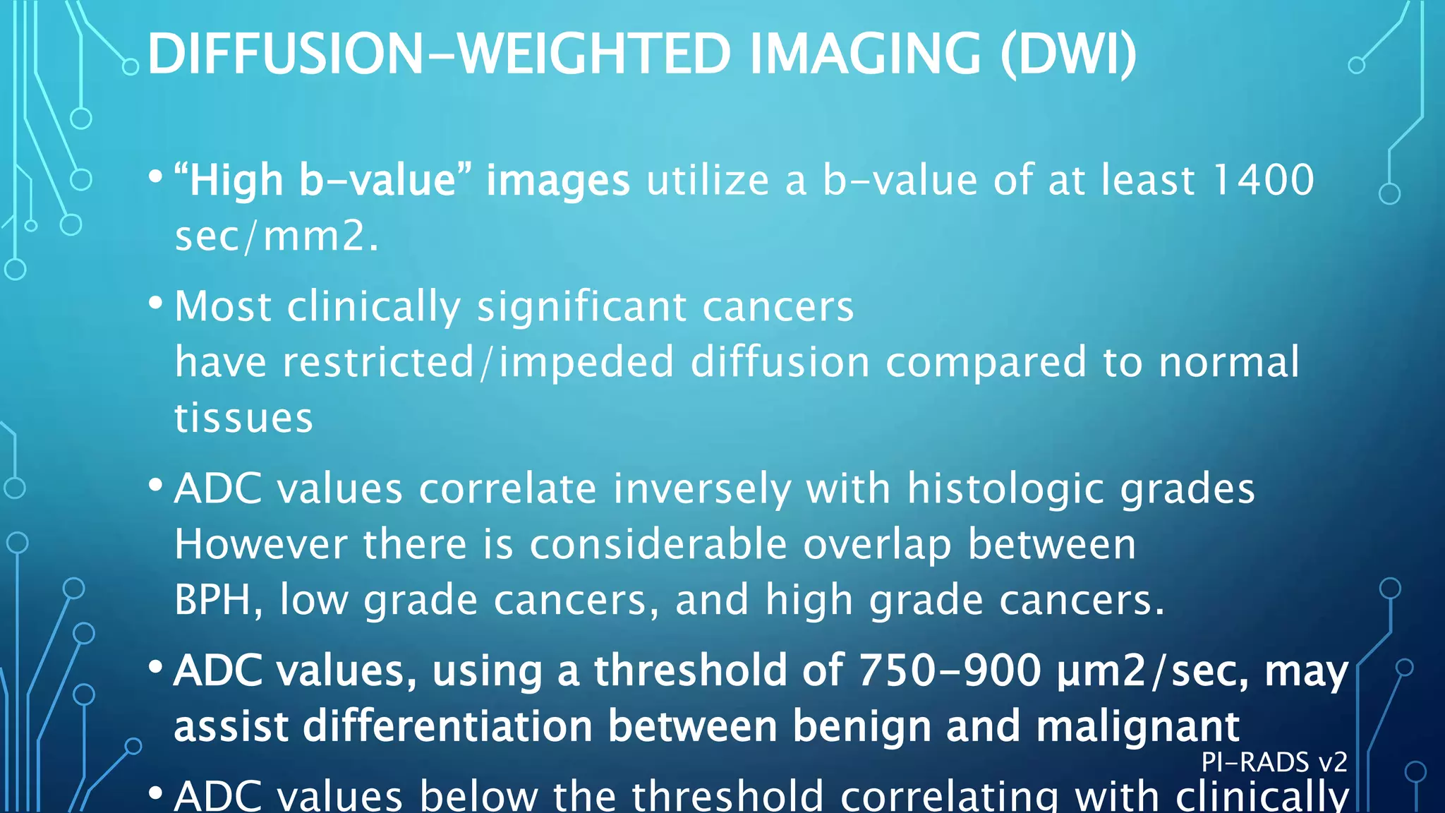 Prostate Imaging - PI-RADS v2.1 | PPTX