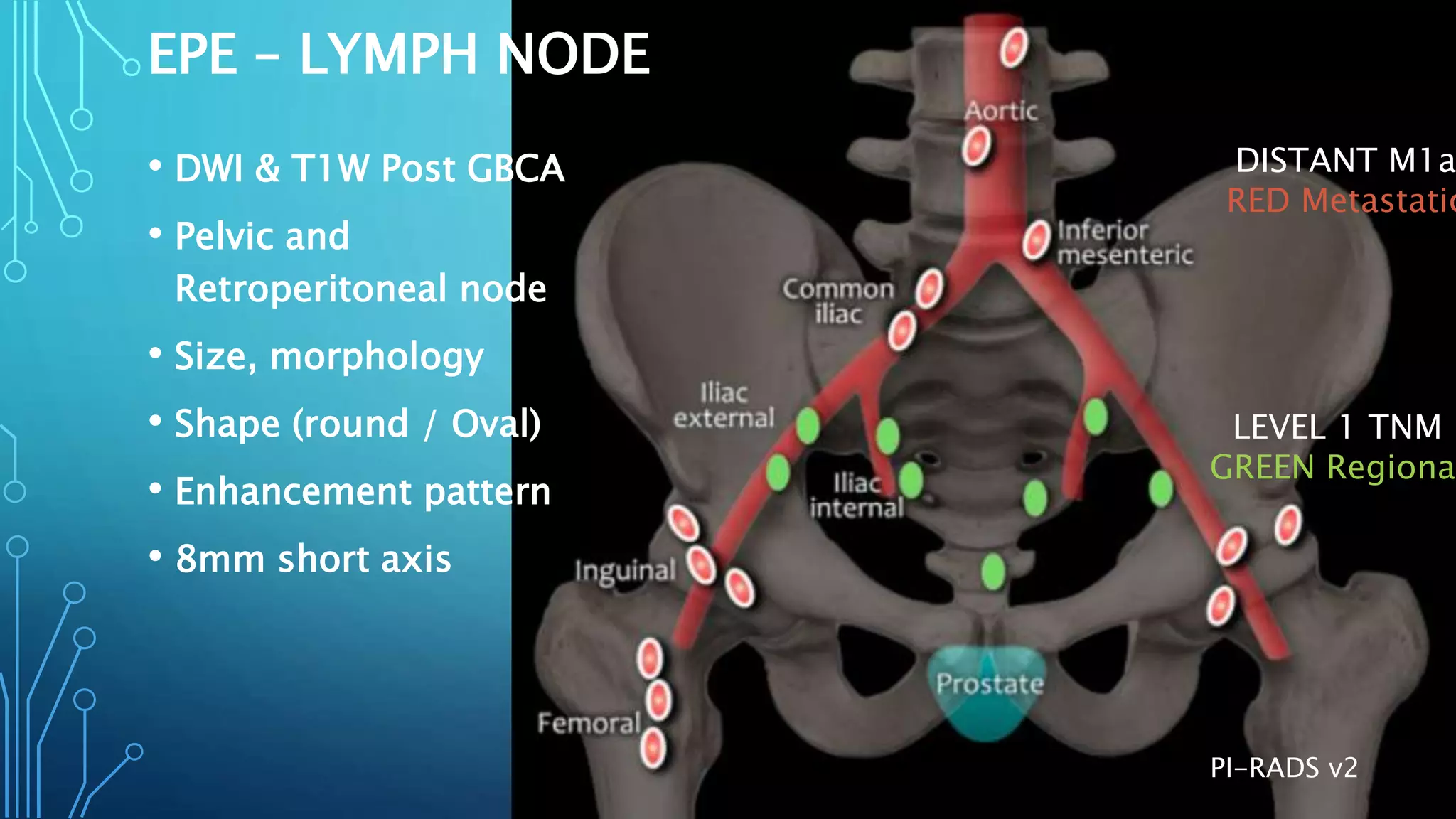Pi Rads Prostea Prostate Imaging - PI-RADS v2.1 | PPTX