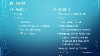 Prostate Imaging - PI-RADS v2.1 | PPTX