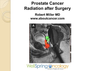 Prostate Cancer
Radiation after Surgery
Robert Miller MD
www.aboutcancer.com

 