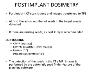 POST IMPLANT DOSIMETRY
• Post implant CT scan is done and images transferred to TPS
• At first, the actual number of seeds in the target area is
detected.
• If there are missing seeds, a chest X-ray is recommended.
CONTOURING
– CTV-P (prostate)
– CTV-PM (prostate + 3mm margin)
– Rectum (“r”)
– intraprostatic urethra (“u”)
• The detection of the seeds in the CT / MRI images is
performed by the automatic seed finder feature of the
planning software
 