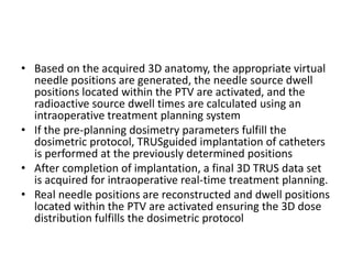 • Based on the acquired 3D anatomy, the appropriate virtual
needle positions are generated, the needle source dwell
positions located within the PTV are activated, and the
radioactive source dwell times are calculated using an
intraoperative treatment planning system
• If the pre-planning dosimetry parameters fulfill the
dosimetric protocol, TRUSguided implantation of catheters
is performed at the previously determined positions
• After completion of implantation, a final 3D TRUS data set
is acquired for intraoperative real-time treatment planning.
• Real needle positions are reconstructed and dwell positions
located within the PTV are activated ensuring the 3D dose
distribution fulfills the dosimetric protocol
 