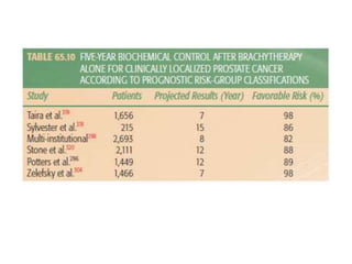 brachytherapy in carcinoma prostate