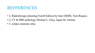 REFFERENCES
• 1. Radiotherapy planning Fourth Edition by Jane ODDS, Tom Roques,
• 2. CT & MRI pathology Michael L. Grey, Jagan M. Ailnani
• 3. eclipse anatomy atlas
 