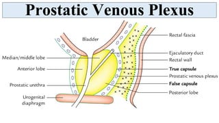 Plexus Prostate Vas Deferens, Prostate, Seminal Vesicle and Ejaculatory duct | PDF