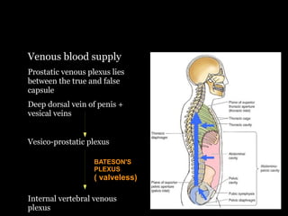 Plexus Prostate Anatomy, pathology an staging work up of prostate cancer | ODP