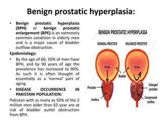 Benign prostatic hyperplasia:
• Benign prostatic hyperplasia
(BPH) or benign prostatic
enlargement (BPE) is an extremely
common condition in elderly men
and is a major cause of bladder
outflow obstruction.
Epidemiology:
• By the age of 60, 50% of men have
BPH, and by 90 years of age the
prevalence has increased to 90%.
As such it is often thought of
essentially as a 'normal' part of
aging.
• DISEASE OCCURRENCE IN
PAKISTANI POPULATION:
Pakistan with as many as 50% of the 2
million men older than 65 year are at
risk of bladder outlet obstruction
from BPH.
 