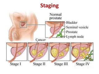 Staging
 