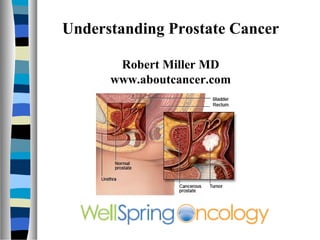 Understanding Prostate Cancer

       Robert Miller MD
      www.aboutcancer.com
 