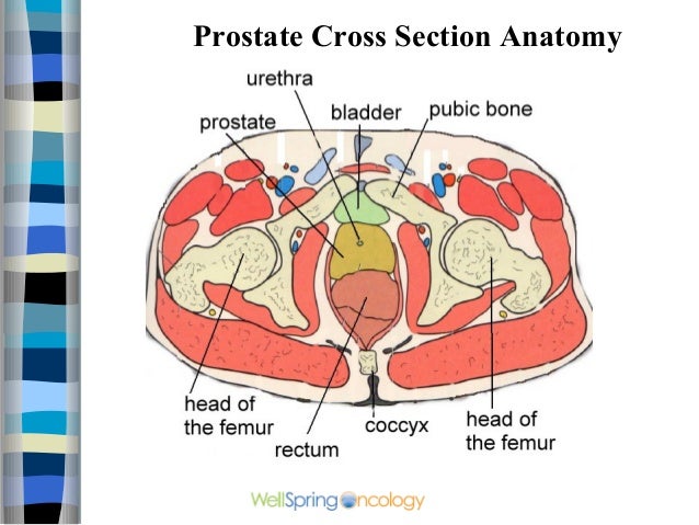 Prostate video 1