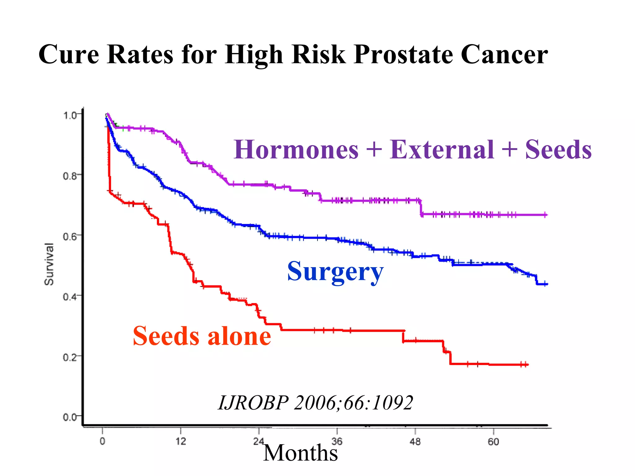 Cure Rates for High Risk Prostate Cancer


               Hormones + External + Seeds



                     Surgery

       Seeds alone

              IJROBP 2006;66:1092

                  Months
 