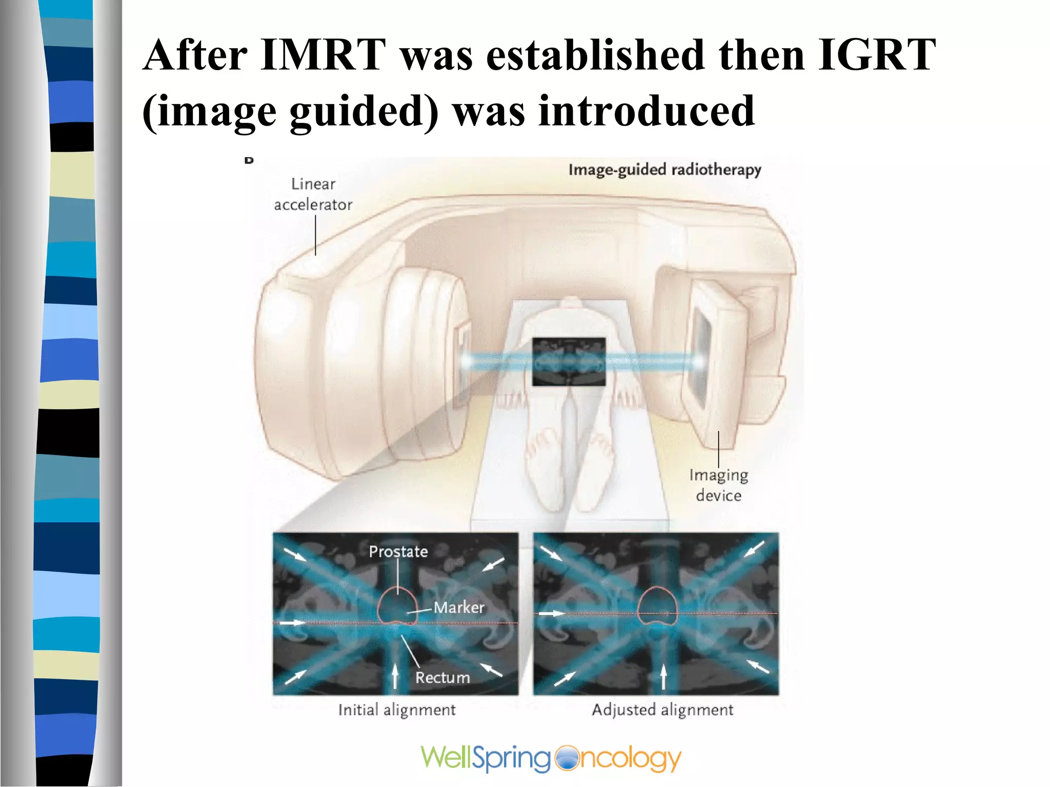 After IMRT was established then IGRT
(image guided) was introduced
 