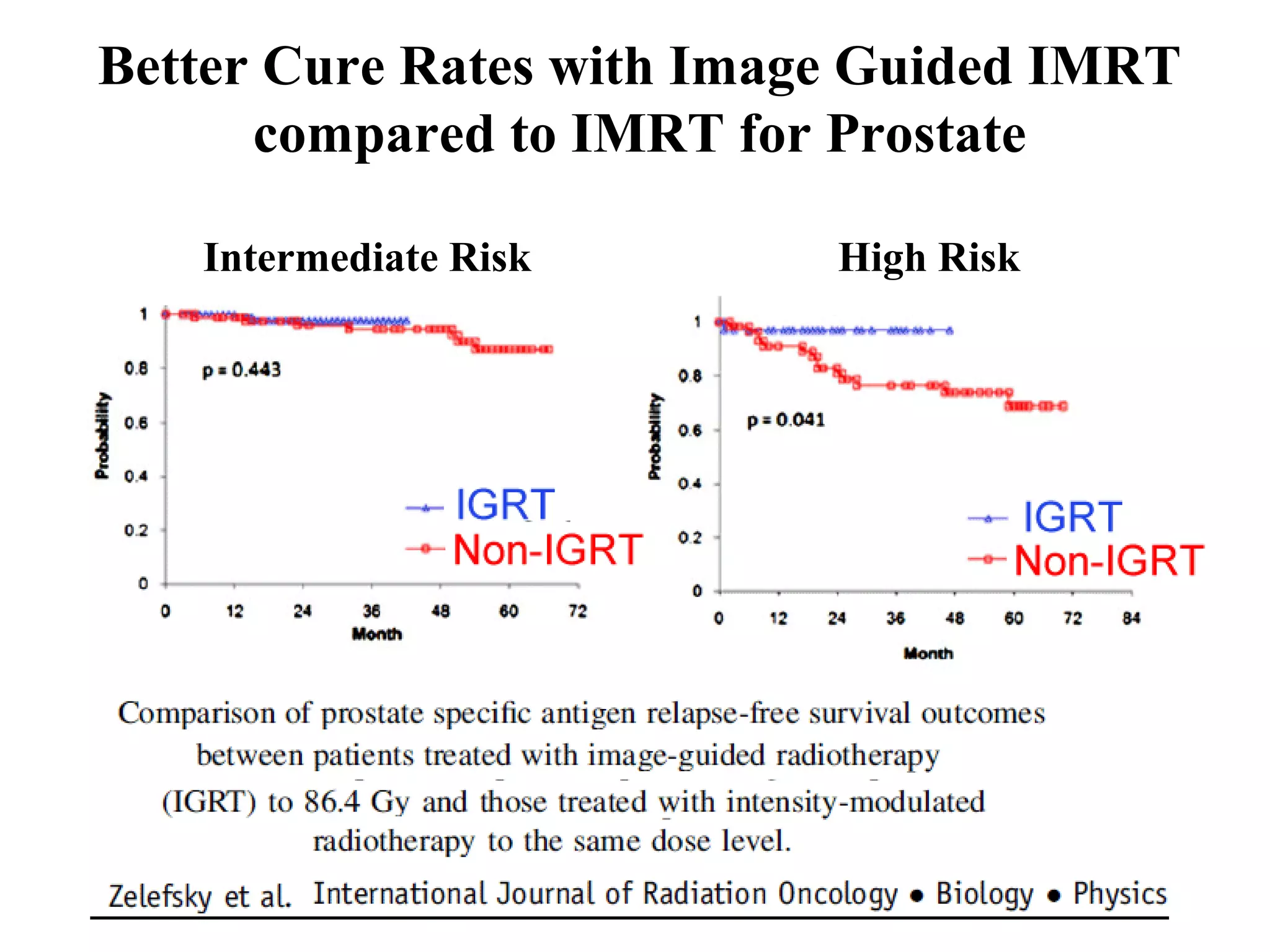 Better Cure Rates with Image Guided IMRT
      compared to IMRT for Prostate

   Intermediate Risk       High Risk
 