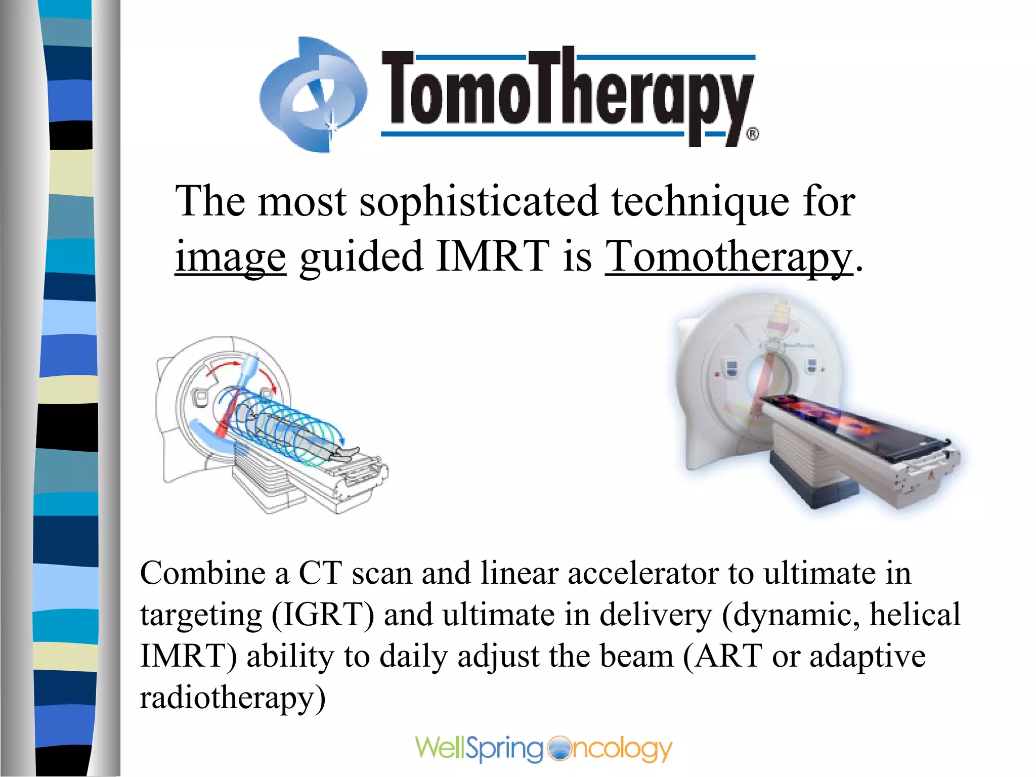 The most sophisticated technique for
  image guided IMRT is Tomotherapy.




Combine a CT scan and linear accelerator to ultimate in
targeting (IGRT) and ultimate in delivery (dynamic, helical
IMRT) ability to daily adjust the beam (ART or adaptive
radiotherapy)
 