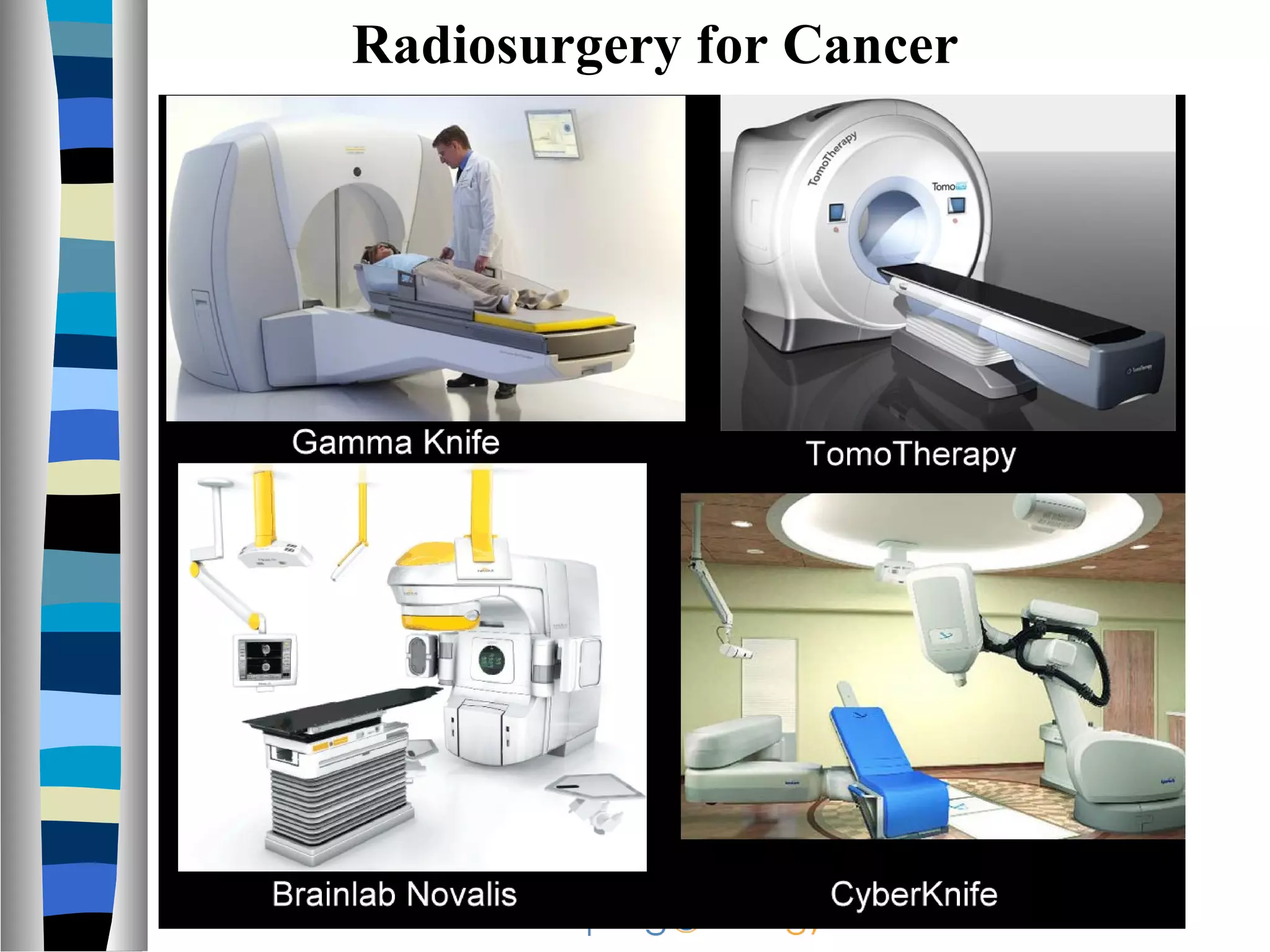 Radiosurgery for Cancer
 