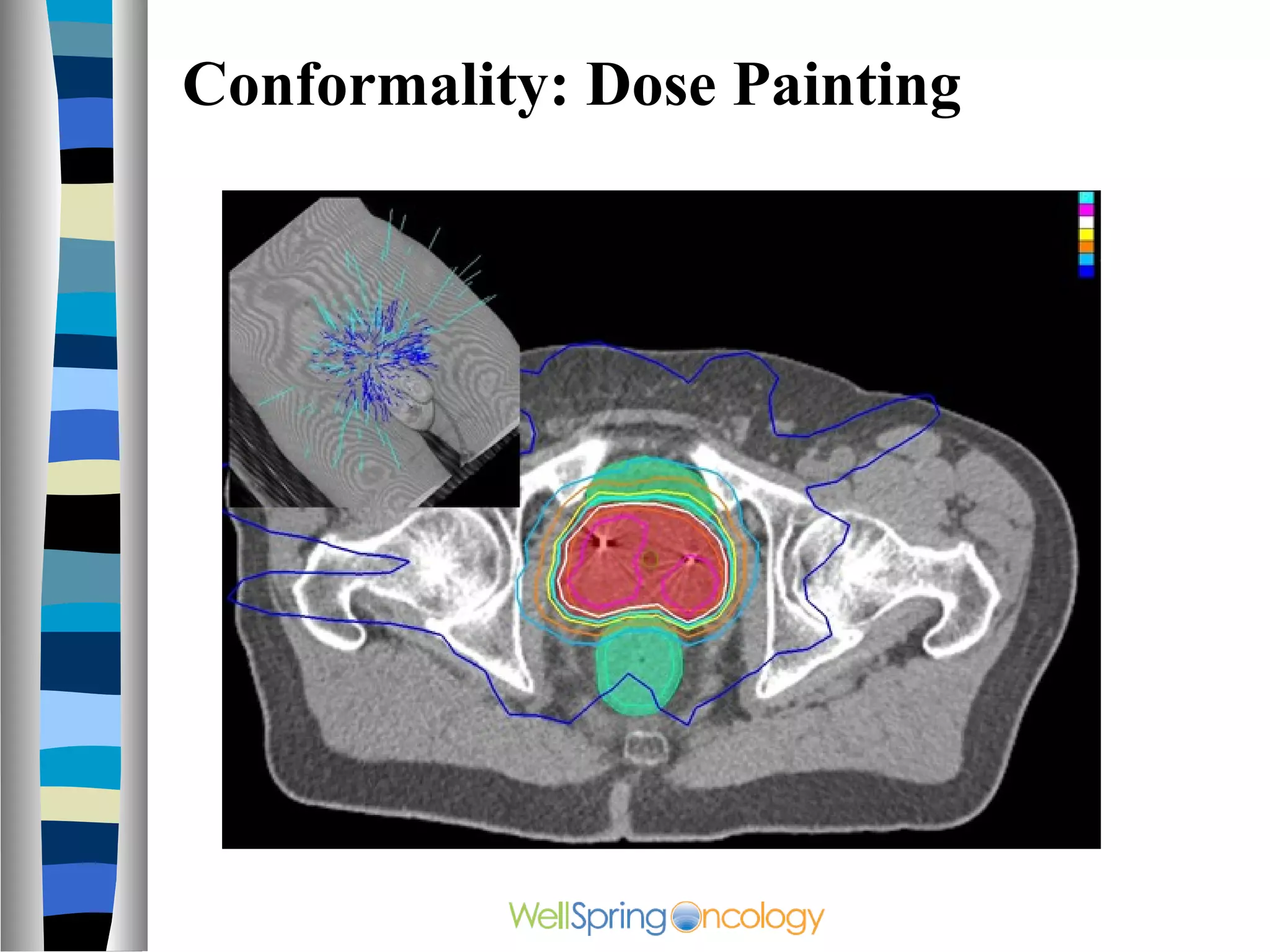 Conformality: Dose Painting
 