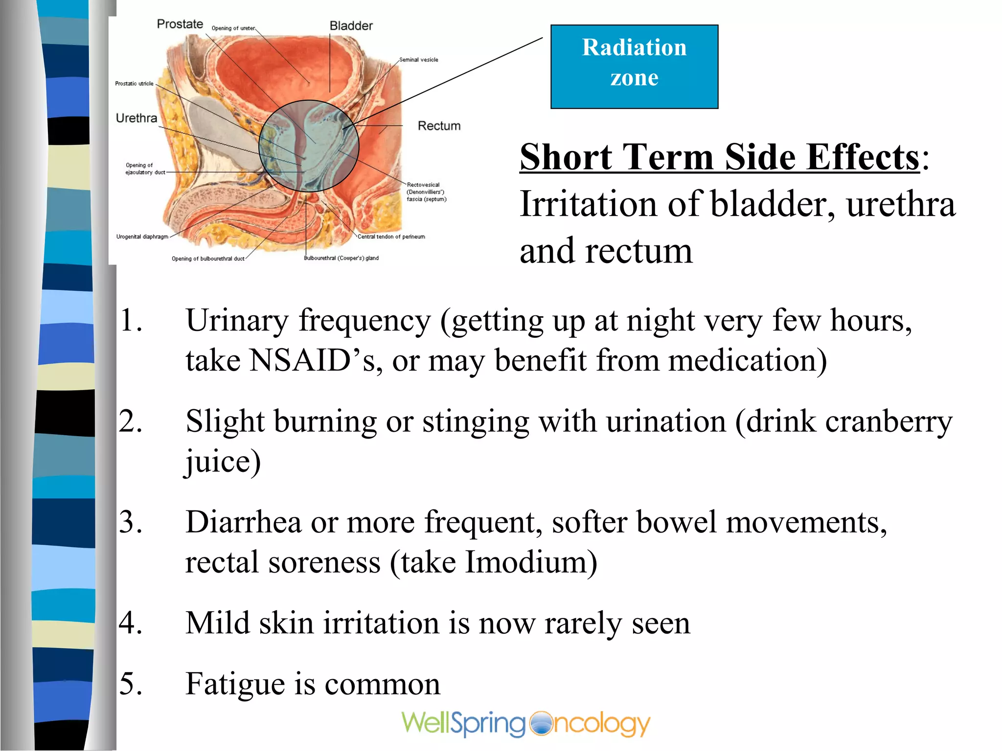 Radiation
                                     zone


                              Short Term Side Effects:
                              Irritation of bladder, urethra
                              and rectum
1.   Urinary frequency (getting up at night very few hours,
     take NSAID’s, or may benefit from medication)
2.   Slight burning or stinging with urination (drink cranberry
     juice)
3.   Diarrhea or more frequent, softer bowel movements,
     rectal soreness (take Imodium)
4.   Mild skin irritation is now rarely seen
5.   Fatigue is common
 