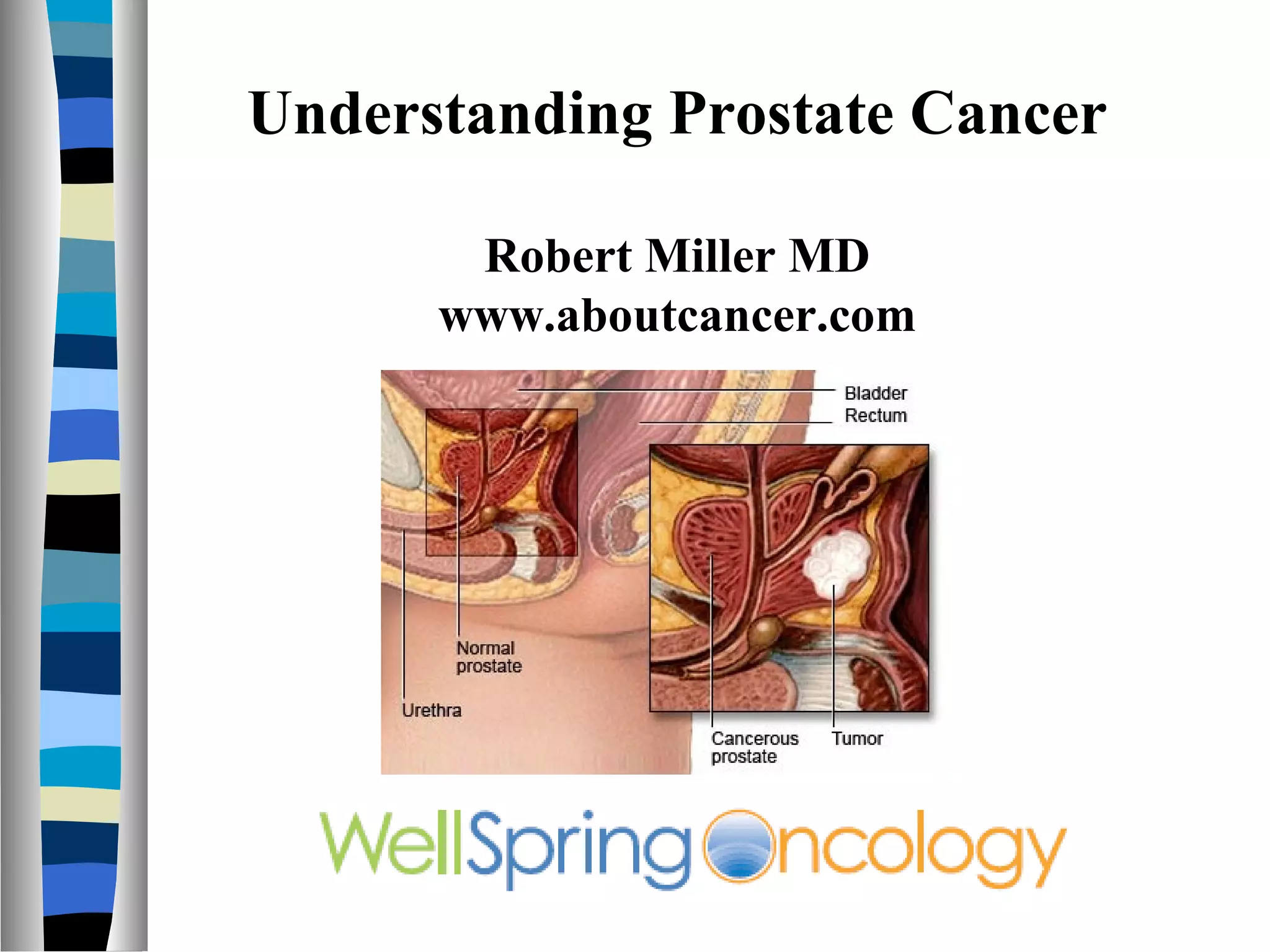 Understanding Prostate Cancer

       Robert Miller MD
      www.aboutcancer.com
 
