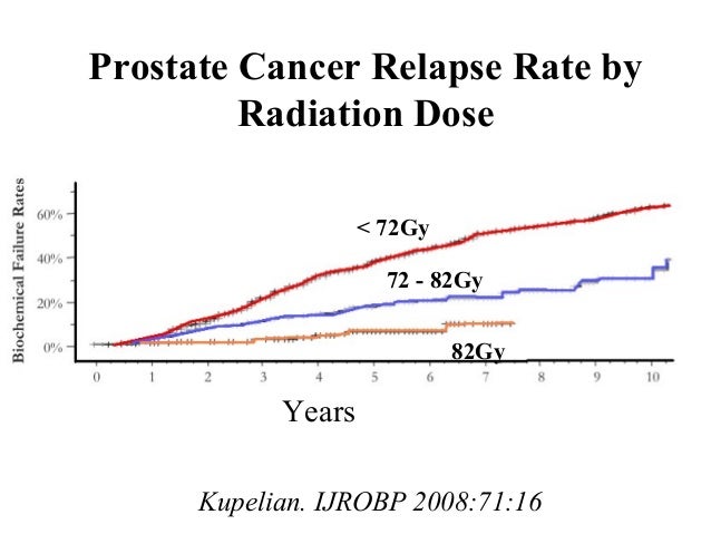 Radiotherapy for Prostate Cancer