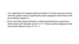 • It is important to recognize Gleason pattern 4 tumor because tumors
with this pattern have a significantly worse prognosis than those with
pure Gleason pattern 3.
• It has also been demonstrated in radical prostatectomy specimens
that tumors with Gleason score 4 + 3 = 7 have a worse prognosis than
those with Gleason score 3 + 4 = 7.
 