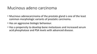 Mucinous adeno carcinoma
• Mucinous adenocarcinoma of the prostate gland is one of the least
common morphologic variants of prostatic carcinoma.
• Has an aggressive biologic behaviour.
• Has a propensity to develop bone metastases and increased serum
acid phosphatase and PSA levels with advanced disease.
 
