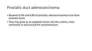 Prostatic duct adenocarcinoma
• Between 0.4% and 0.8% of prostatic adenocarcinomas arise from
prostatic ducts.
• They may grow as an exophytic lesion into the urethra, most
commonly in and around the verumontanum.
 