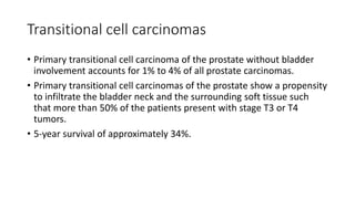 Transitional cell carcinomas
• Primary transitional cell carcinoma of the prostate without bladder
involvement accounts for 1% to 4% of all prostate carcinomas.
• Primary transitional cell carcinomas of the prostate show a propensity
to infiltrate the bladder neck and the surrounding soft tissue such
that more than 50% of the patients present with stage T3 or T4
tumors.
• 5-year survival of approximately 34%.
 