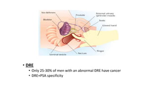 • DRE
• Only 25-30% of men with an abnormal DRE have cancer
• DRE+PSA specificity
 
