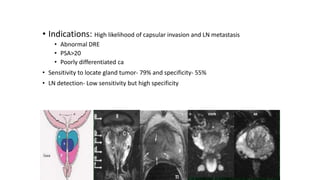 • Indications: High likelihood of capsular invasion and LN metastasis
• Abnormal DRE
• PSA>20
• Poorly differentiated ca
• Sensitivity to locate gland tumor- 79% and specificity- 55%
• LN detection- Low sensitivity but high specificity
 
