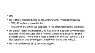 • O/E
• He is thin emaciated, has pallor, and inguinal lymphadenopathy .
CVS, RS within normal Limits
P/A a firm 3x3 cm mass palpable in the abdomen below umbilicus
• On Digital rectal examination , he has a Hard, nodular, asymmetrical
swelling in the prostate gland Firmness extending superior to the
prostate gland. There was a mass palpable in the anal canal at 12 o
clock position and the finger stained with blood and mucus.
• He had tenderness at L1 vertebra region.
 