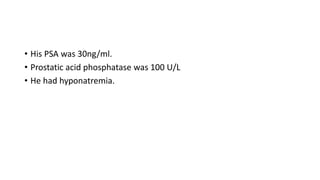 • His PSA was 30ng/ml.
• Prostatic acid phosphatase was 100 U/L
• He had hyponatremia.
 