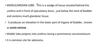 • MIDDLE/MEDIAN LOBE- This is a wedge of tissue situated behind the
urethra and in front of ejaculatory ducts , just below the neck of bladder
and contains much glandular tissue.
• It produces an elevation in the lower part of trigone of bladder , known
as uvula vesicae .
• Middle lobe projects into urethra raising a prominence verumontanum
• It is common site for adenoma.
 