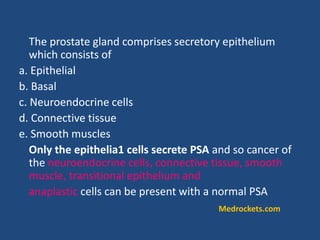 The prostate gland comprises secretory epithelium
which consists of
a. Epithelial
b. Basal
c. Neuroendocrine cells
d. Connective tissue
e. Smooth muscles
Only the epithelia1 cells secrete PSA and so cancer of
the neuroendocrine cells, connective tissue, smooth
muscle, transitional epithelium and
anaplastic cells can be present with a normal PSA
Medrockets.com
 
